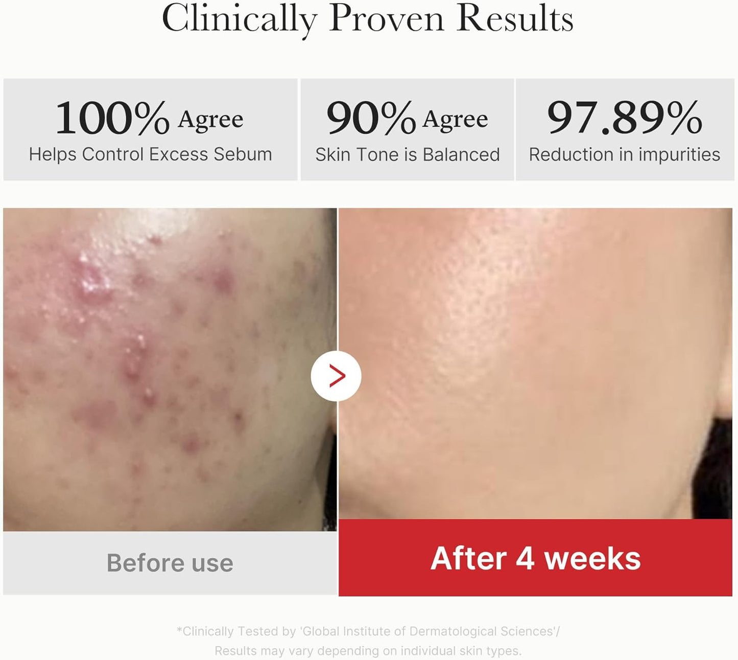 CalmiSkin™ Red Renew Pads