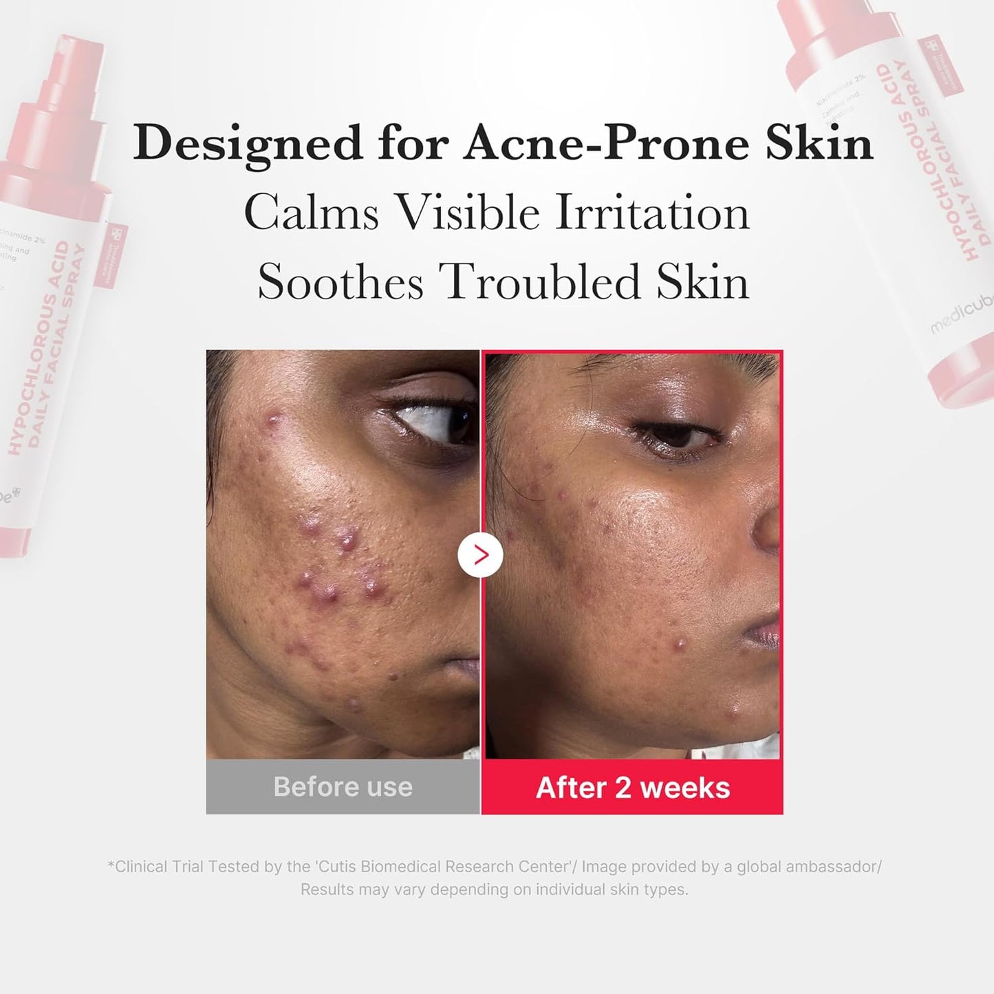 Medicube Power Soothing Hypochlorous Acid Facial Mist: Calm, Hydrate, Refresh Skin